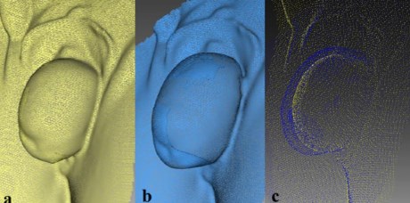 A new method for the evaluation of pelvic organ prolapse in women using a three- dimensional optic scanner